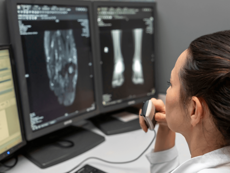 Réduire la charge cognitive des médecins avec DMO et Dicma